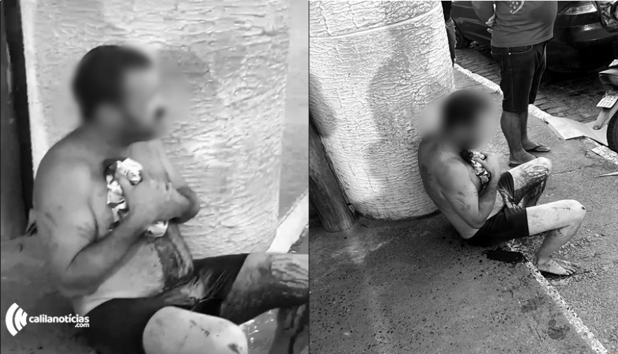 Homem é socorrido após ser atingido por golpe de faca em Conceição do Coité