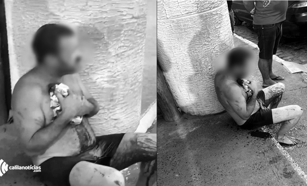 Homem é socorrido após ser atingido por golpe de faca em Conceição do Coité